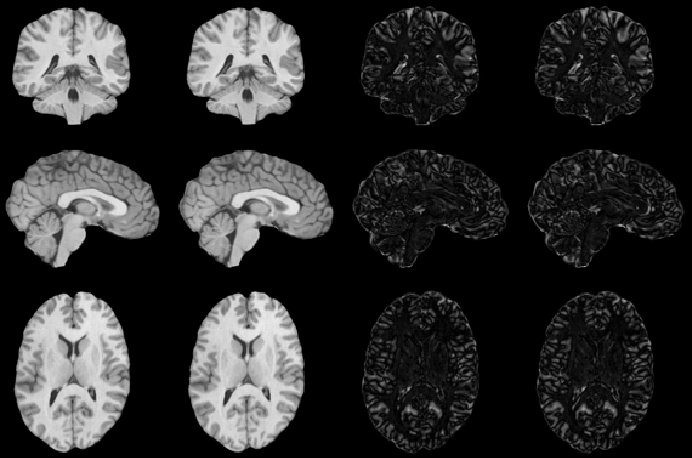 \scalebox{0.8}{\includegraphics{trans_paper01.figs/brains/b009_To_b104_noicc_icc_def_dif_3x4small}}