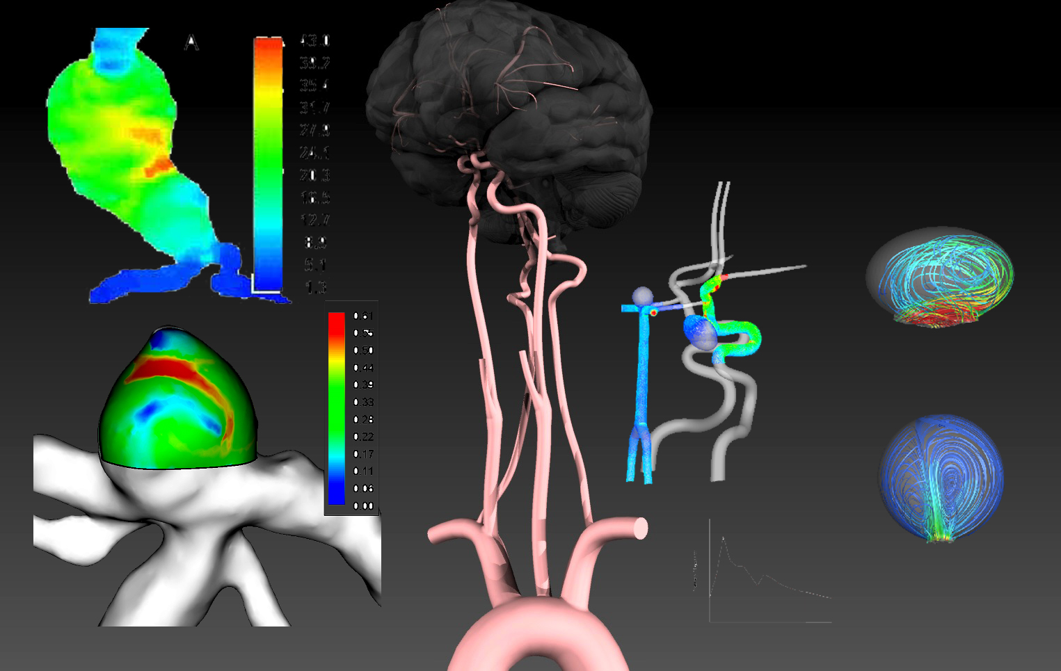 Isolation of Cerebral Aneurysms