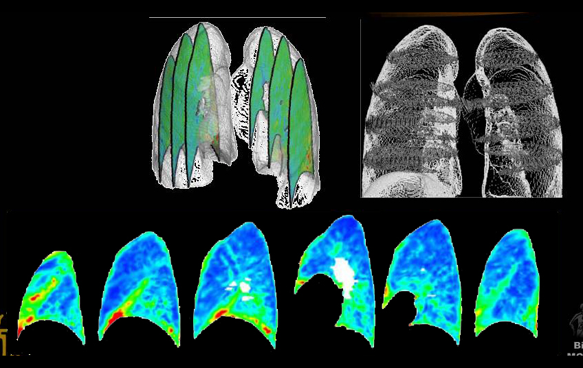 Biomechanical tissue testing