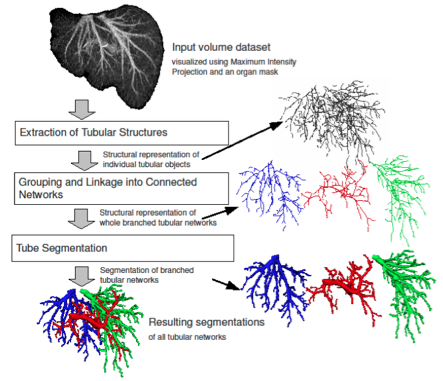 liver_vessels