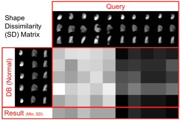 lungshapeanalysis